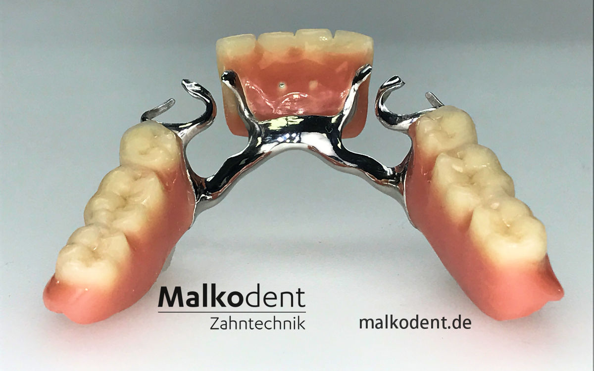 Removable Partial Dentures